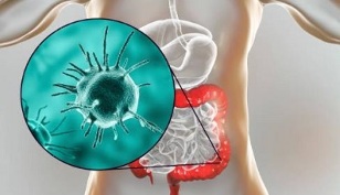 parazitler için hangi testler yapılmalı