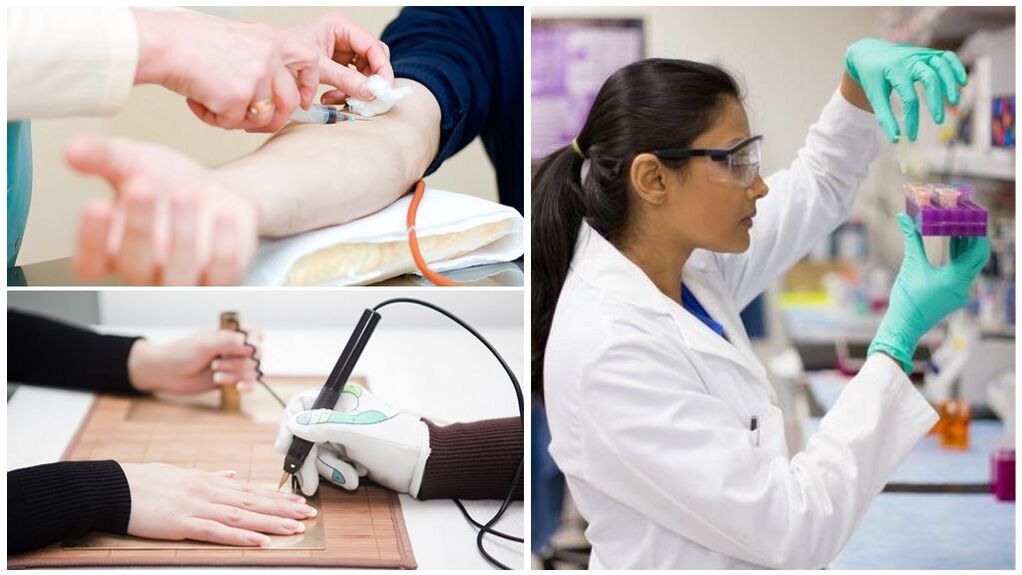 Vücuttaki parazitleri tespit etmek için teşhis yöntemleri