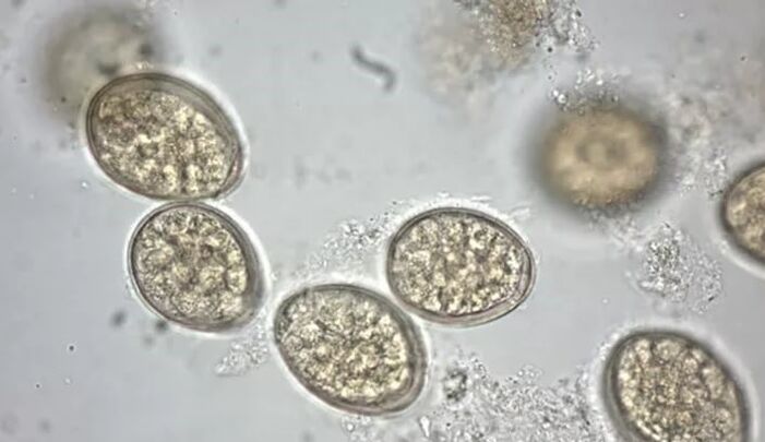 mikroskop altında parazitler